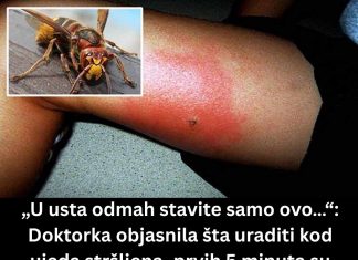 „U usta odmah stavite samo ovo…“: Doktorka objasnila šta uraditi kod ujeda stršljena, prvih 5 minuta su ključni