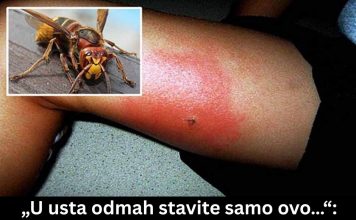 „U usta odmah stavite samo ovo…“: Doktorka objasnila šta uraditi kod ujeda stršljena, prvih 5 minuta su ključni