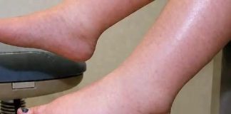 DA IZBACITE VIŠAK VODE POTREBAN VAM JE JEDAN VITAMIN: Ni noge vam više neće oticati, samo ga ubacite u ishranu…